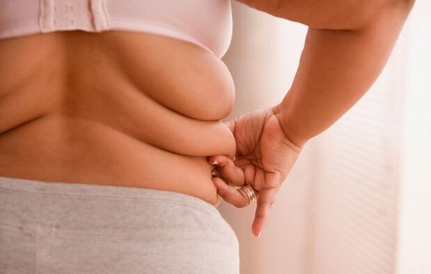 Η παχυσαρκία, η αιτία της οστεοχόνδρωσης του τραχήλου της μήτρας σε γυναίκες κάτω των 40 ετών